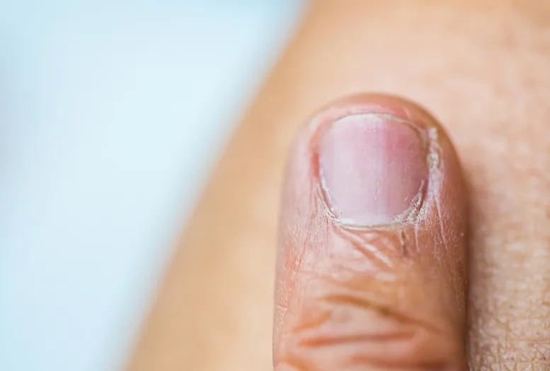 Do jakiego lekarza z paznokciami? Sprawdź, kto pomoże w problemach