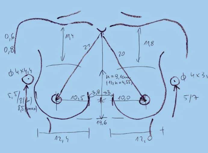 Czy hormony i geny decydują o wzroście biustu? Sprawdź kluczowe czynniki