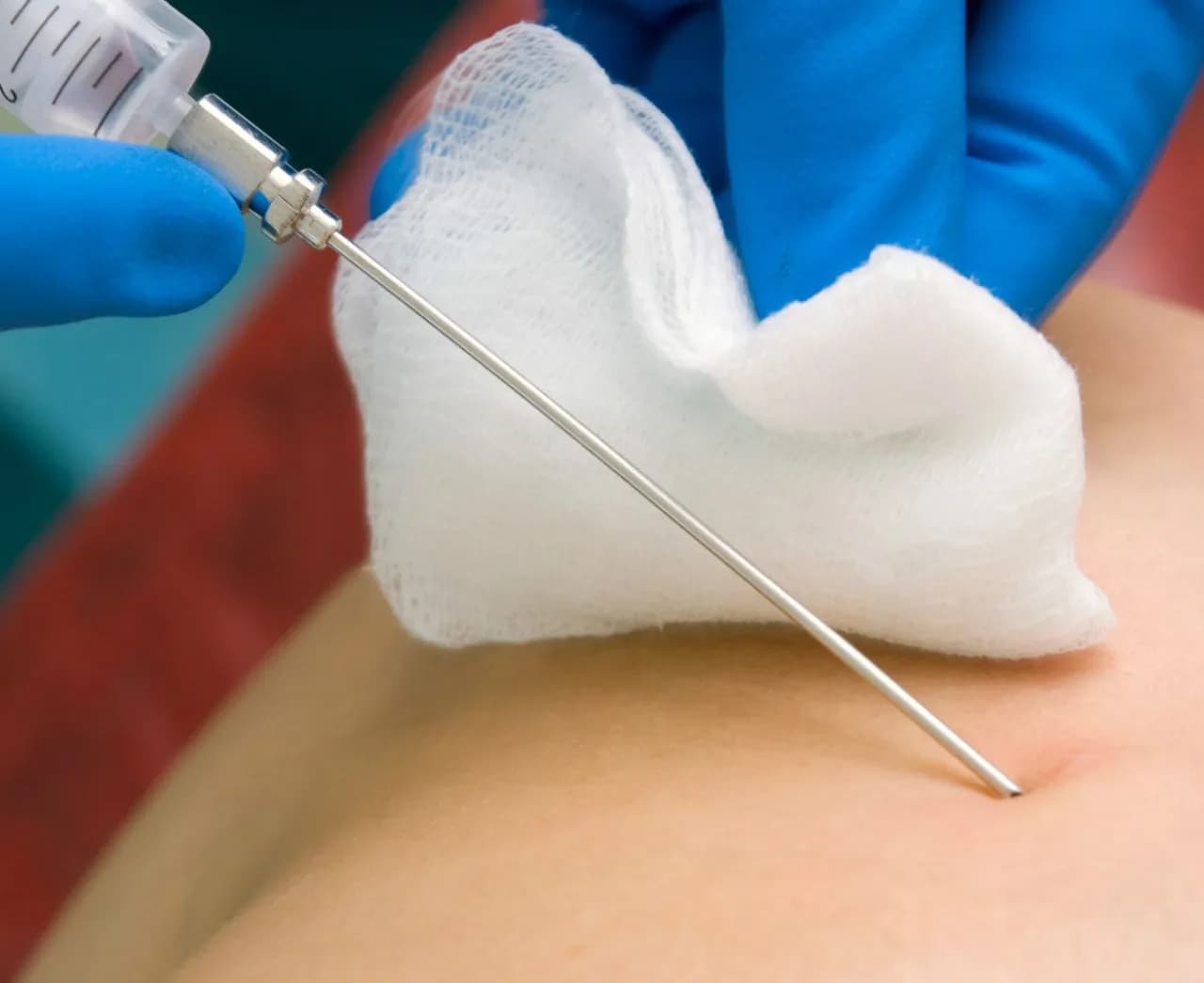 Czy miesiączka jest przeciwwskazaniem do biopsji? Ważne informacje